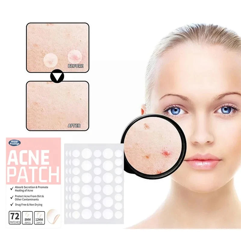 Adesivo Invisível Impermeável Patch de Espinhas Dry Skin-72 Pçs /Para o Rosto-Adesivo Hidrocoloides Para Acne +Produto Natural Ervas Selecionadas